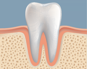 bone tissue, bone graft
